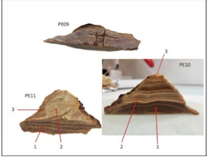 قطع من الجمجمة