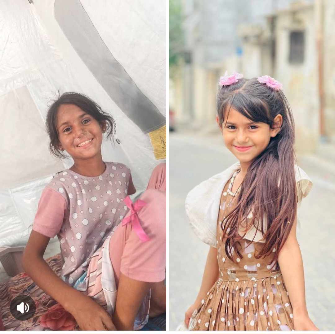 الطفلة صابرين جهاد الهمص .. قبل الحرب وفي الحرب