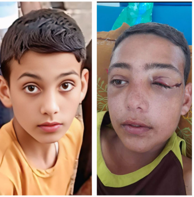 عبد الرحمن أبو جزر