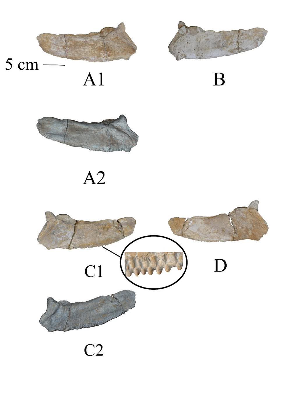 جانب من تشكيل الاسنان الحادة