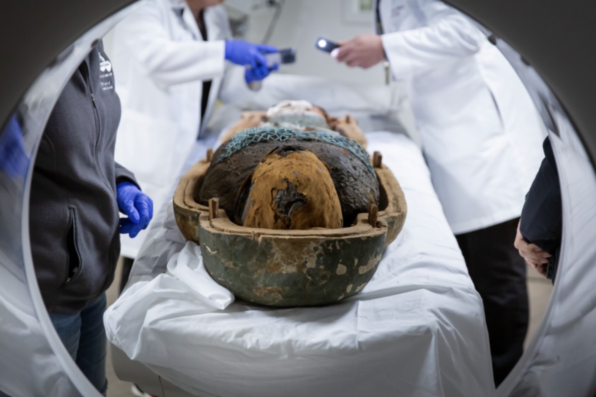 فحص التصوير المقطعى