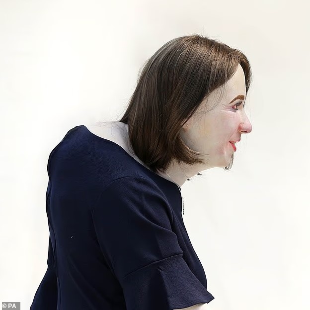 حدبة الرقبة حدبة الرقبة