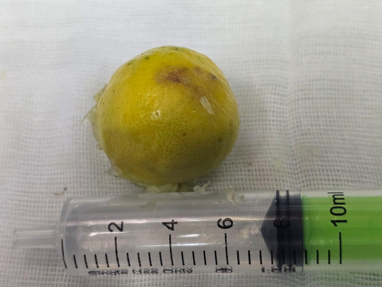 الليمونة المستخرجة من الشاب