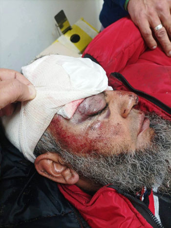 الاصابة الاصابة