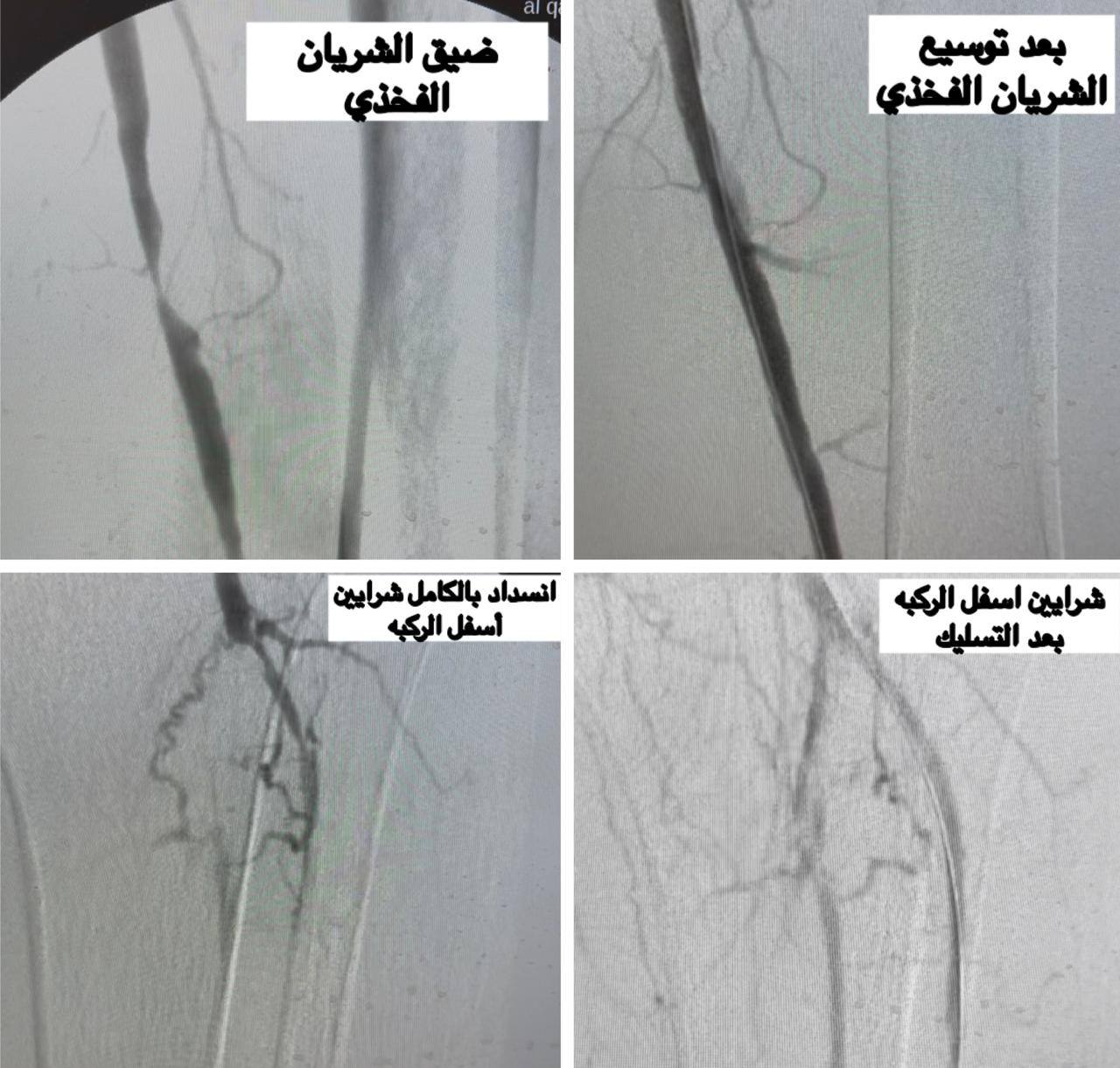 الأشعة الخاصة بالمرضى