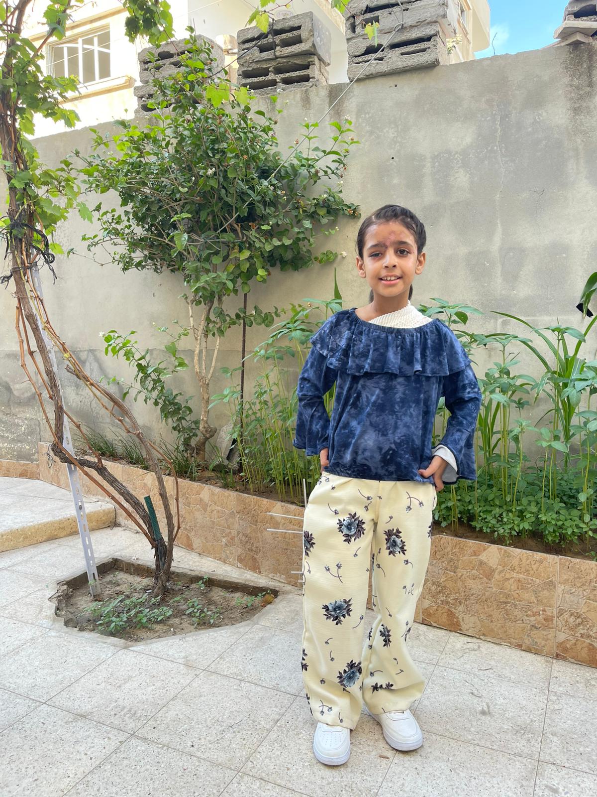 الطفلة جود عزام