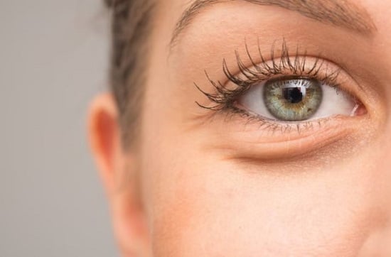 طرق التخلص من الهالات السوداء