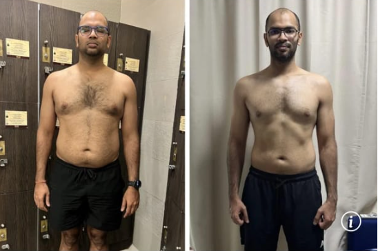 قبل وبعد فقدان الوزن