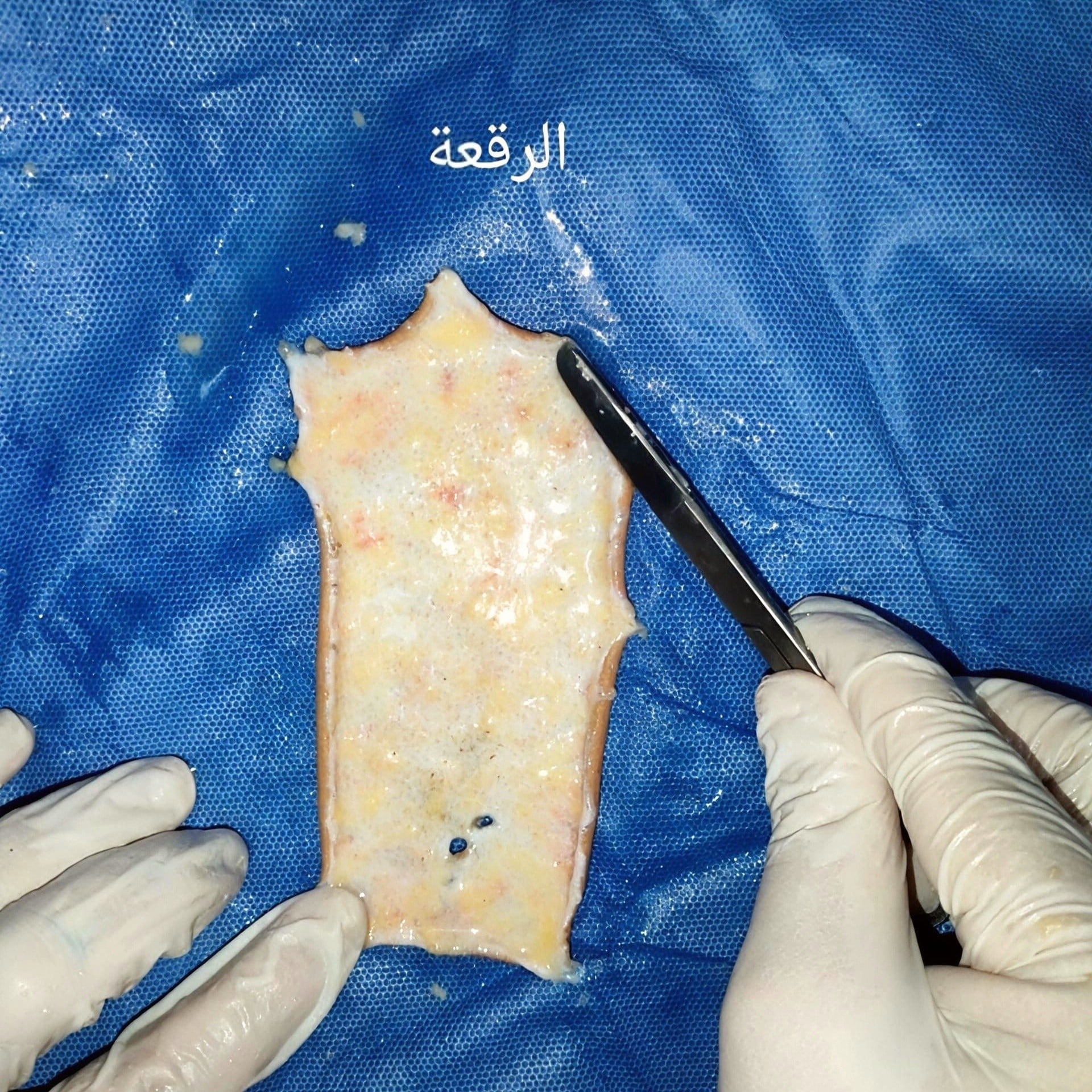 الرقعة