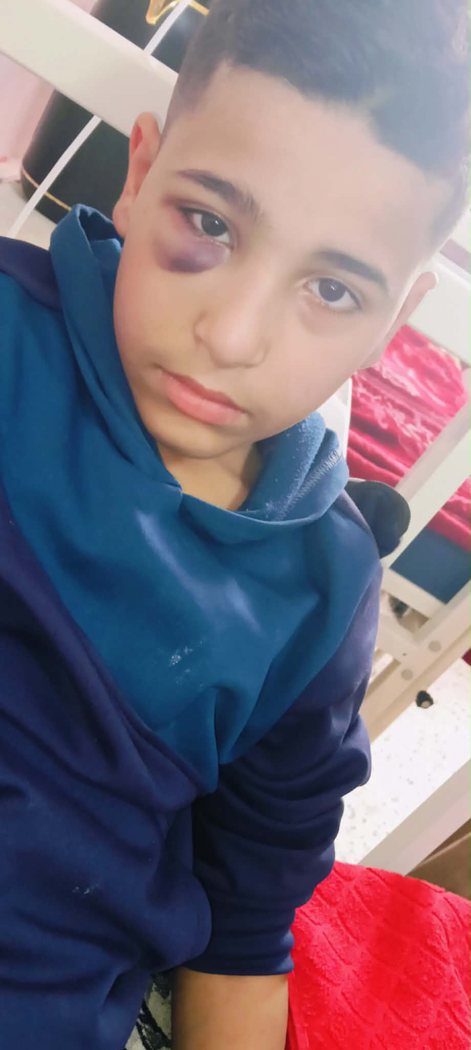 الطفل المريض وليد أبو مصطفى