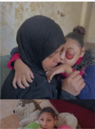 وفاة الطفلة هناء العوضى من السرطان بسبب الحرب
