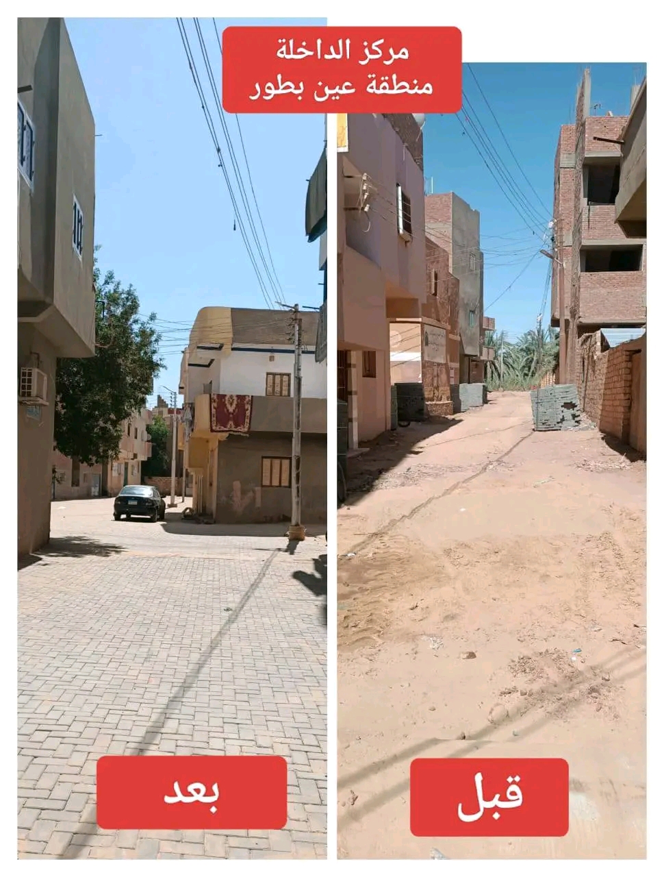 عين بطور بالداخلة قبل وبعد عين بطور بالداخلة قبل وبعد
