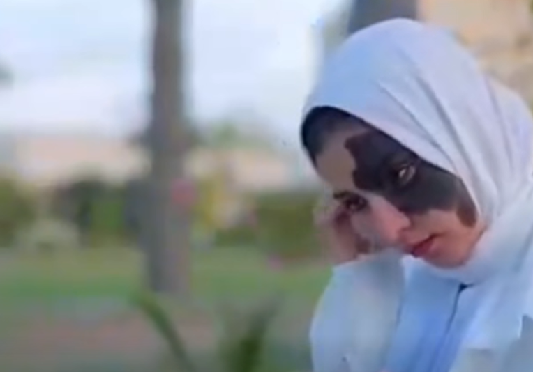 الوحمة في بطلة الفيلم