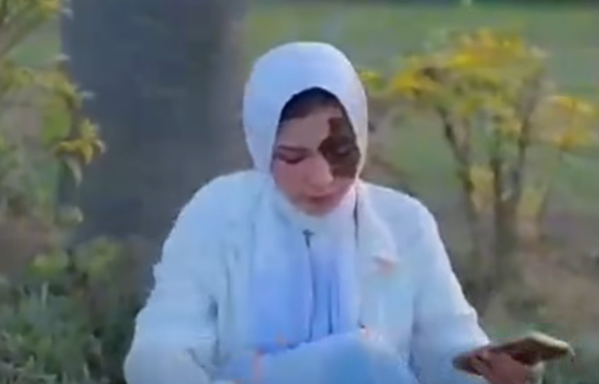 الوحمة في وجه الفتاة وجه القمر