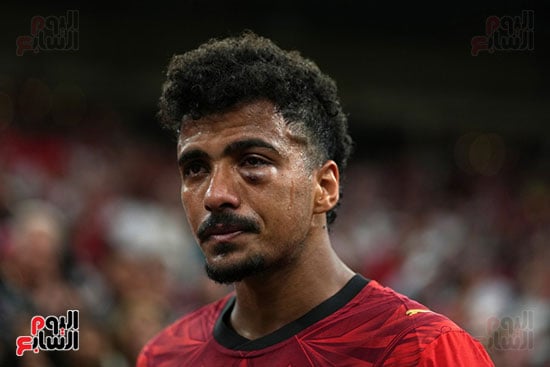 إصابة حسام عبد المجيد إصابة حسام عبد المجيد
