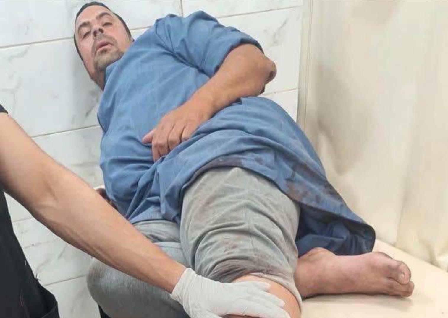 أحد ضحايا الكلب