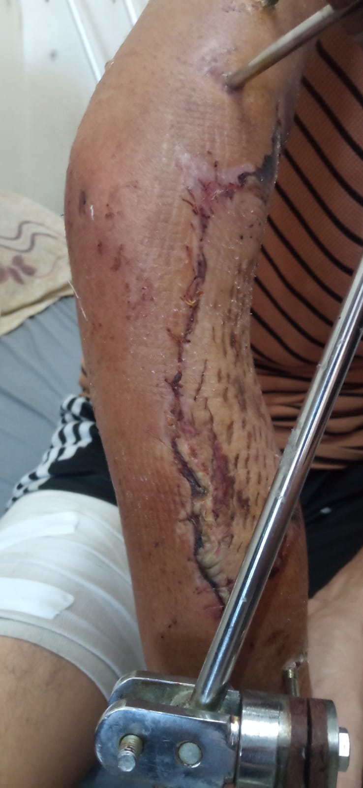 إصابة مجدي زعيتر
