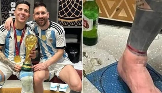 ميسى والسوار الاحمر 