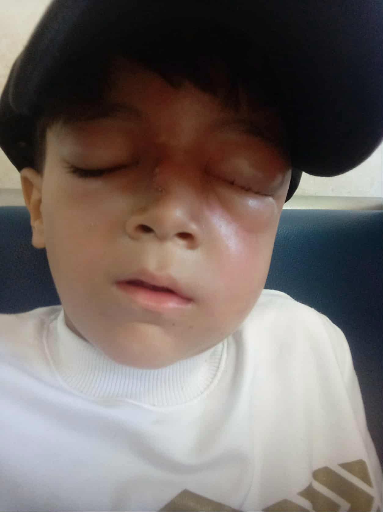 الطفل زين الدين محمد