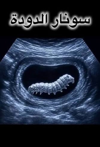 دودة البطن