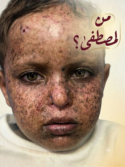 مصطفى محمد