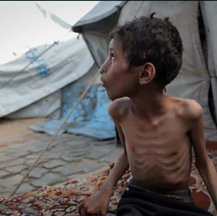 الطفل محمد السوسى