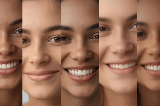 أنواع الابتسامات أنواع الابتسامات