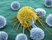 خلايا سرطانية 
