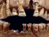أسنان الأفراد الذين تم العثور عليهم في جزيرة جوتلاند السويدية
