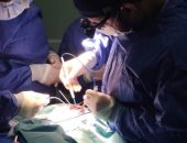 استخراج ملعقة من معدة فتاة 19 عامًا بمعهد الكبد فى المنوفية