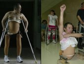  صينى ينقسم جسده لنصفين فى حادث ويعود للسير مرة أخرى