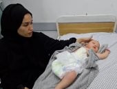 مشهد يهز القلوب.. بتر ساق رضيع فلسطينى بسبب غارة إسرائيلية على غزة.. صورة