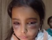 الطفلة المجني عليها