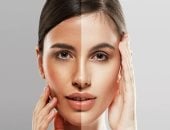 وصفات طبيعية لتفتيح لون البشرة