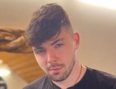 شاب مصاب بهوس نتف الشعر