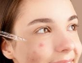 إخفاء ندبات الوجه 