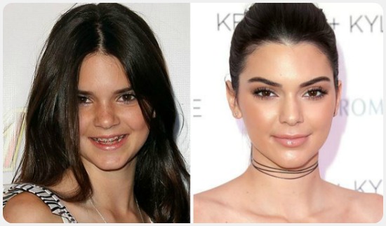 عائلة كارداشيان كيم كارداشيان (5)