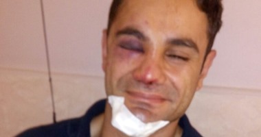بودى جاردات "حماقى" يضربون ضابطا بأكتوبر.. ونقله للمستشفى فى حالة خطرة بودى جاردات "حماقى" يضربون ضابطا بأكتوبر.. ونقله للمستشفى فى حالة خطرة