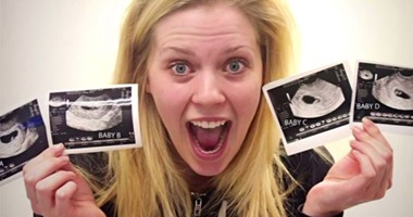 بالفيديو والصور..إجراء جراحة نادرة لـ4 توائم داخل بطن الأم