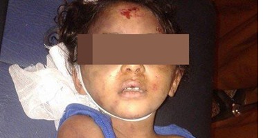 العثور على جثة طفلة مقتولة وبها آثار تعذيب أسفل كوبرى بمصر القديمة