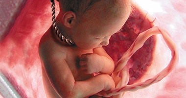 80 % من الإجهاض يحدث فى أول ثلاثة أشهر من الحمل.. اكتشف أعراضه