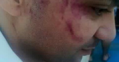 بالفيديو..نائب أردنى ومرافقيه يعتدون على عامل مصرى بالضرب المبرح بالعقبة