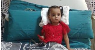 بالصور.. نجاح جراحة قلب نادرة لطفلة عمرها سنة بمستشفى جامعة المنصورة