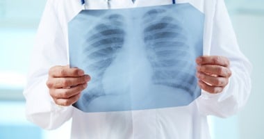 الصحة: مصر وسويسرا استثمرتا 40مليون فرنك لتطوير أقسام الأشعة بالمستشفيات