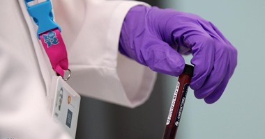 4 حالات ضرورية.. متى تحتاج لإجراء تحليل نسب الفوسفات فى الدم؟