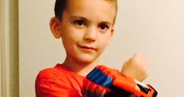 طفل بدون أصابع يحصل على يد سبايدرمان مصنوعة بطابعة ثلاثية الأبعاد