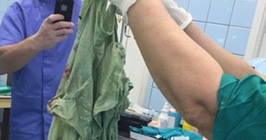 على الطريقة المصرية.أطباء روس يتركون قطعة قماش فى بطن سيدة حامل