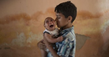 زيكا يقتل 139 طفلا بالبرازيل ويصيب 641 بصغر الرأس