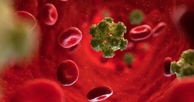 باحثون أمريكيون: فحص دم جديد يمكنه التنبؤ بعودة الإصابة بسرطان الحلق