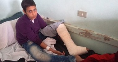 أب يتهم معلما بكسر ساق نجله أثناء امتحانات الإعدادية ببنى سويف